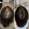 ALOVA scalp pre-wash treatment